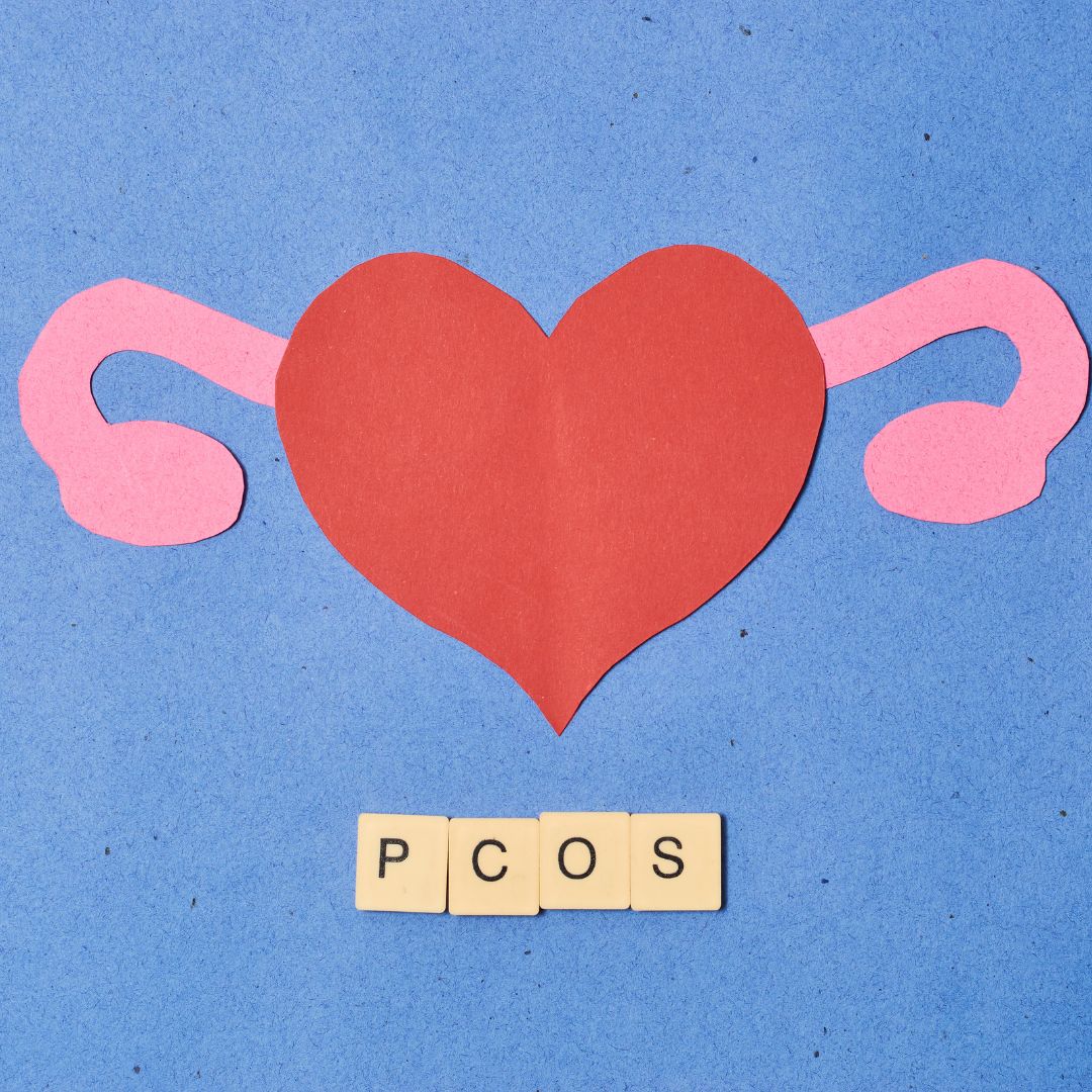  PCOS: Sindrome de ovario poliquístico